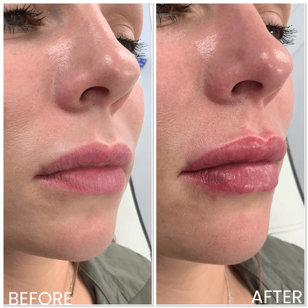 Before & After 11