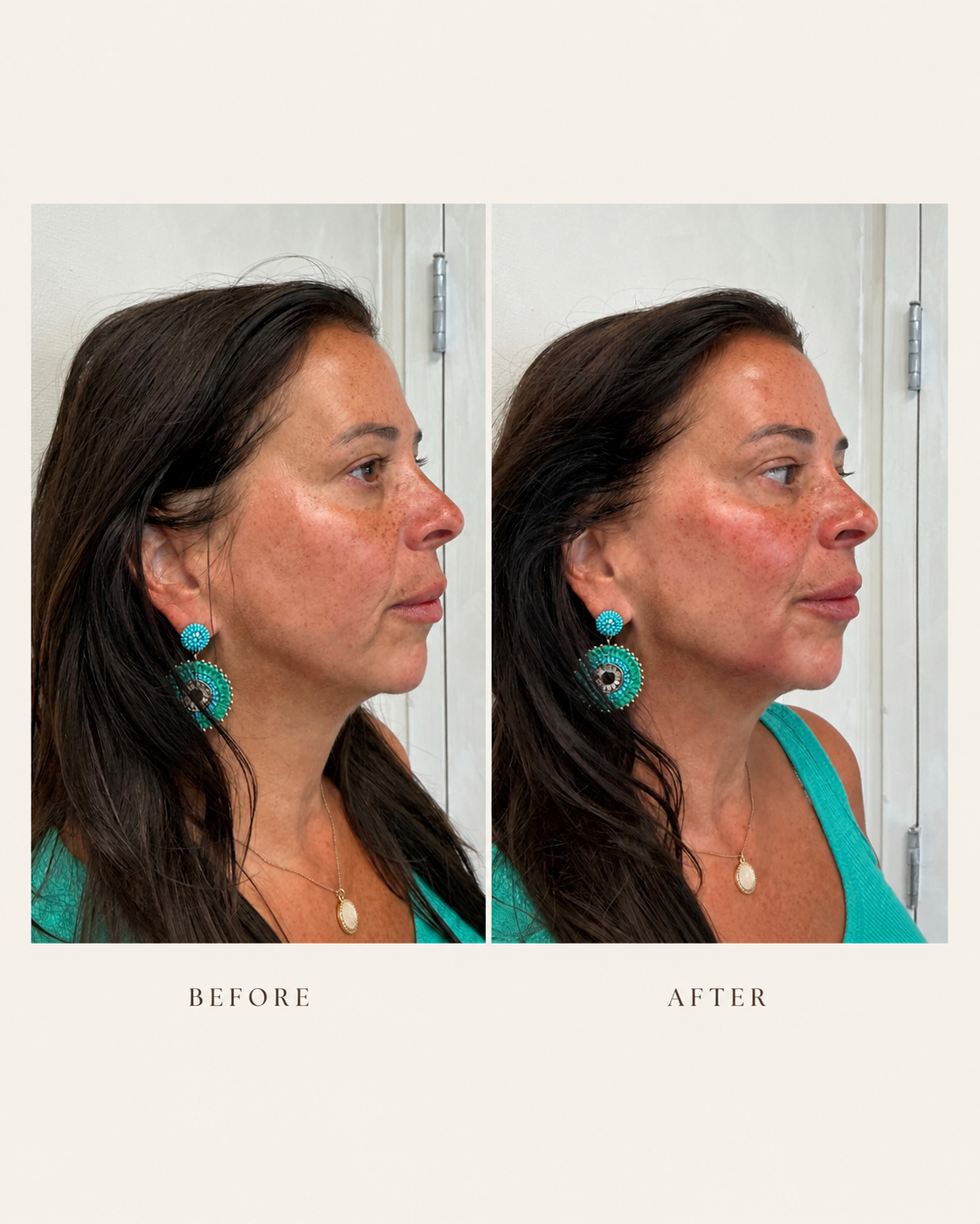 Before & After 5