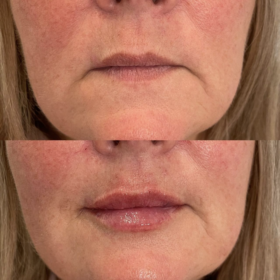 Before & After 13
