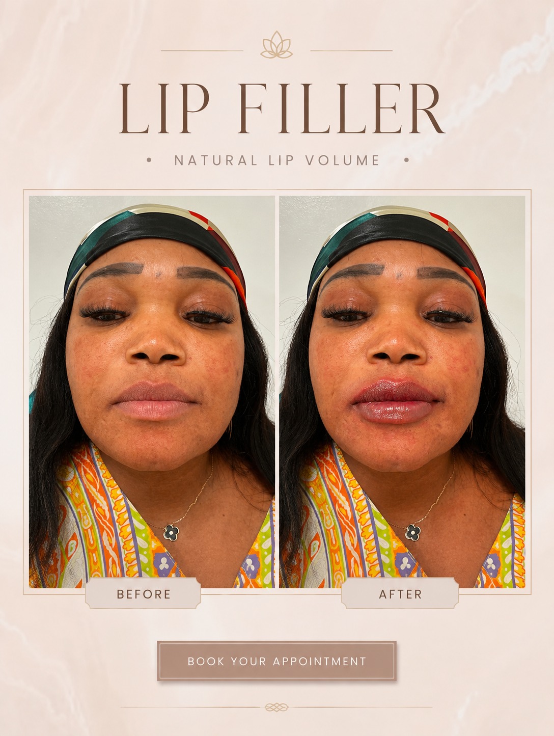 Before & After 8