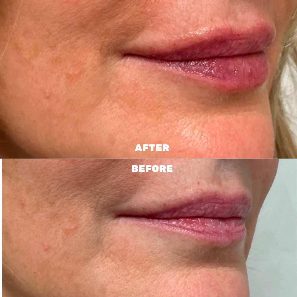 Before & After 9