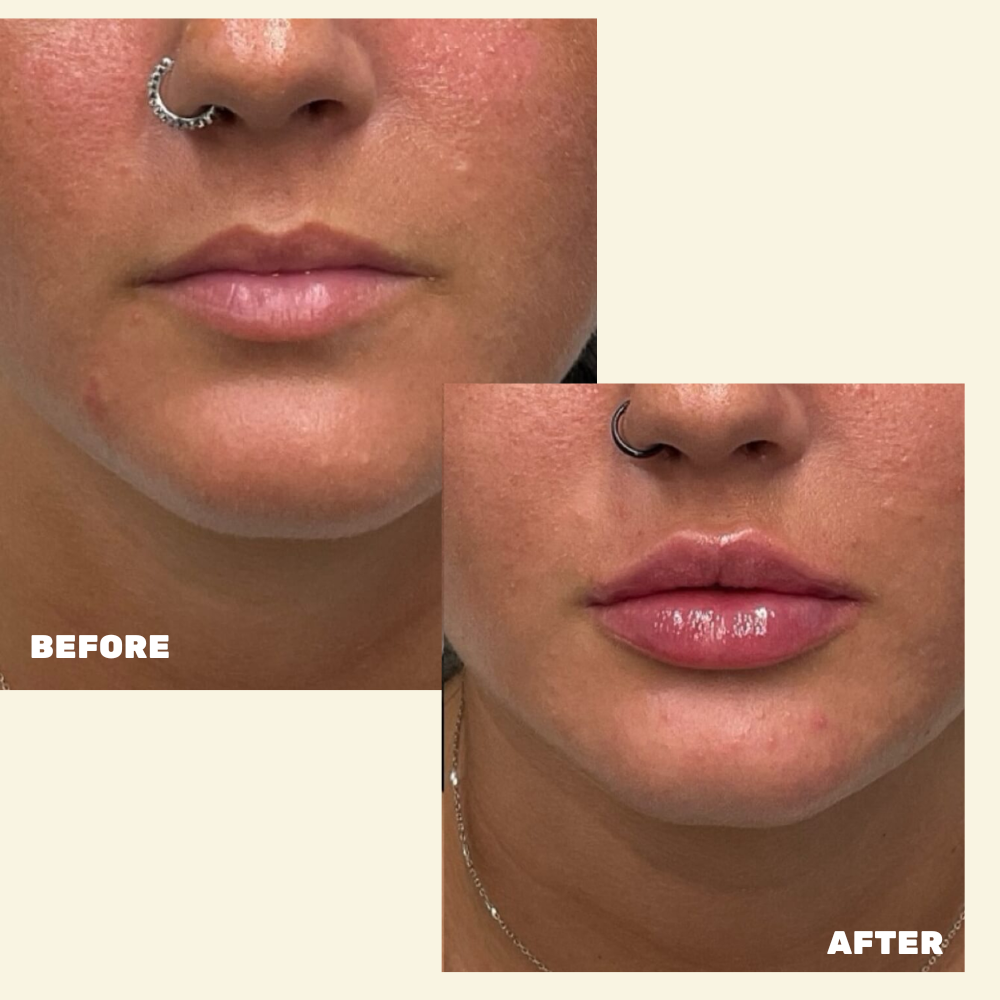 Before & After 10