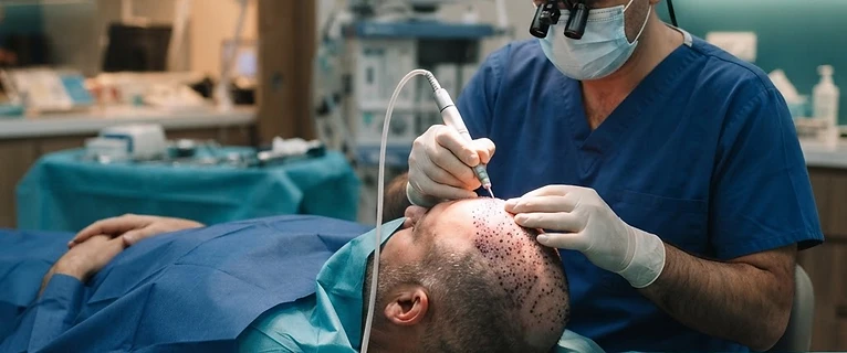 מנתח מבצע השתלת שיער בשיטת FUE בעזרת מיקרו-מוטור בחדר טיפולים מודרני.