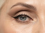 Lifted Hooded Eye