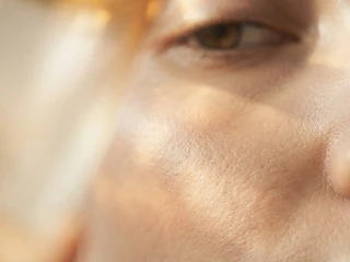 Understanding Pigmentation: Causes and Clinical Approaches