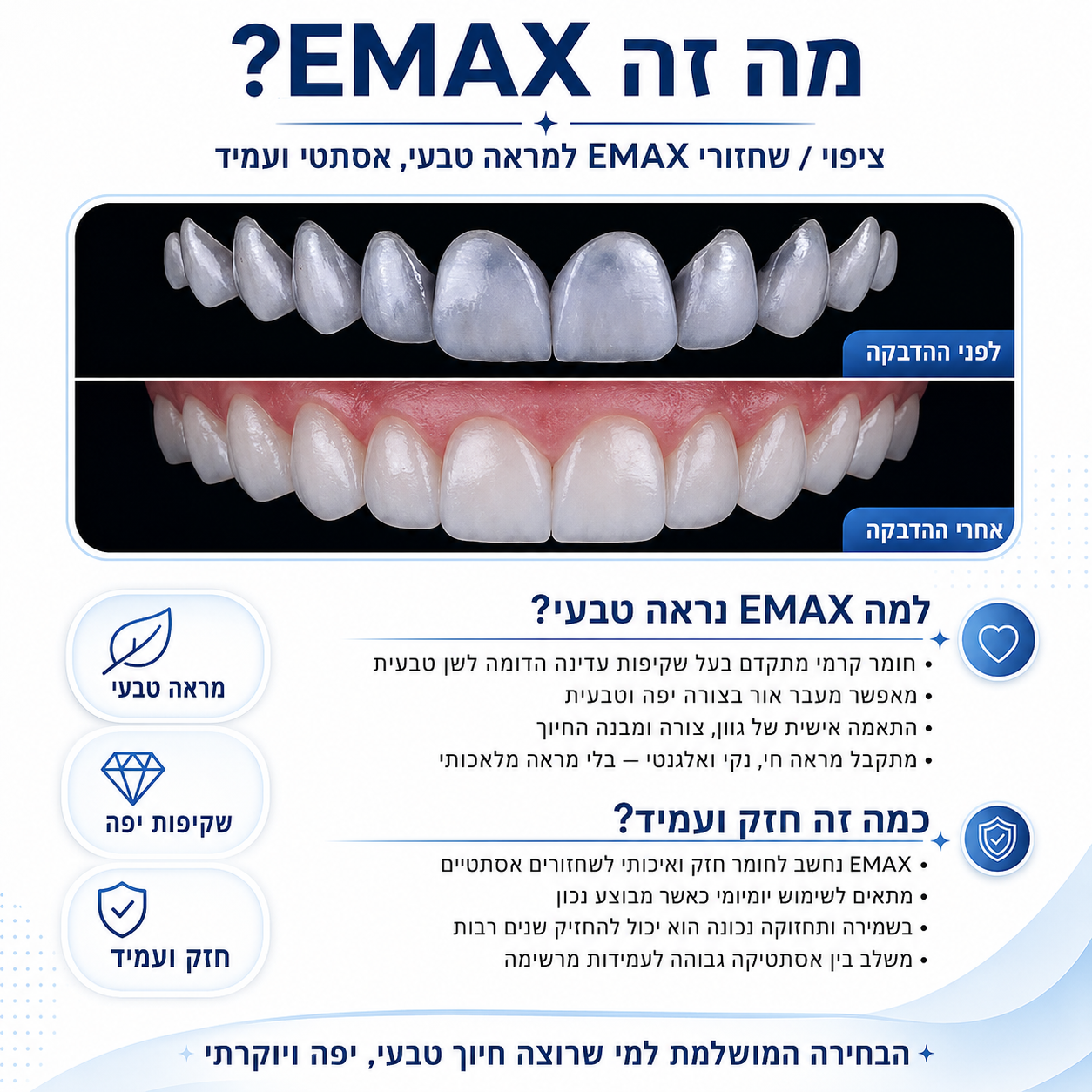 מה זה EMAX - ציפויי קרמיקה ב-O.B Dent