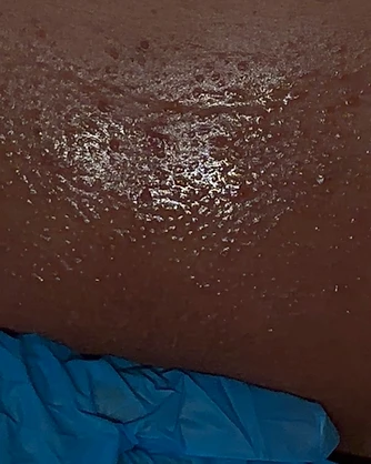 Brazilian Wax