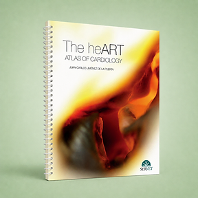 The HeART, Juan Carlos Jiménez de la Puerta, book cover