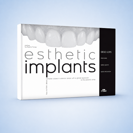 Esthetic Implants book cover