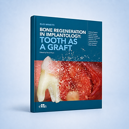 Bone regeneration in implantology: tooth as a graft book cover