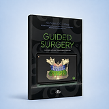 Guided Surgery - Making Implant Placement Simpler book cover