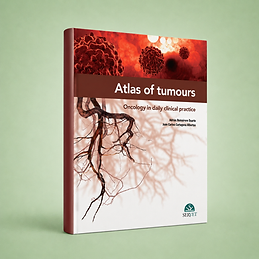 Atlas of Tumours book cover