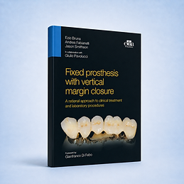 Fixed prosthesis with vertical margin closure book cover