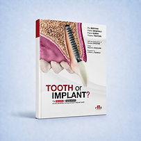 Tooth or Implant? The recovery or replacement of the severely compromised natural tooth book cover