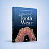 Managing Tooth Wear