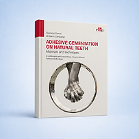 Adhesive cementation on natural teeth book cover