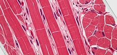 Follistatin and Myostatin: The Science of Muscle Growth Regulation