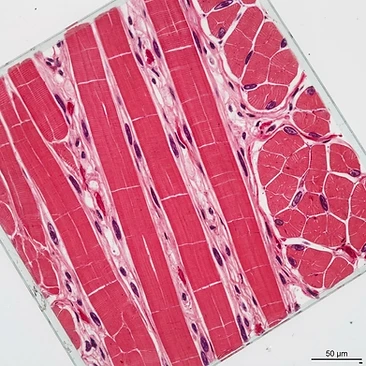 Follistatin and Myostatin: The Science of Muscle Growth Regulation