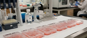 IGF-1 Variants in Research: DES, LR3, and PEG-MGF Compared