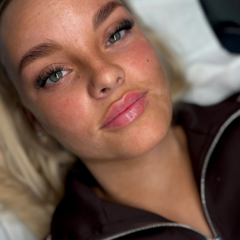 Skin treatment — Result