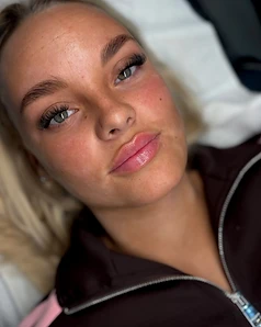 Skin treatment — Result