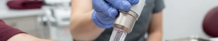 Macro view of laser tattoo removal equipment and texture