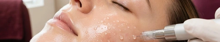 Macro view of skin boosters equipment and texture
