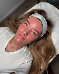 Skincare — Result