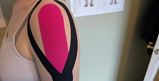 Kinesiology taping applied to a shoulder