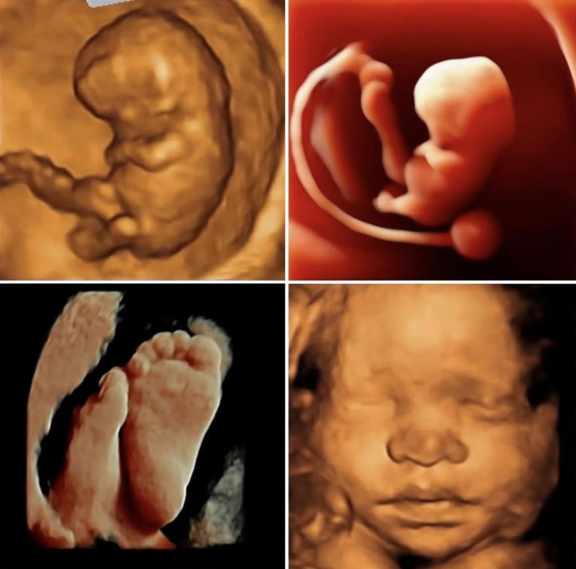 Ultrasonidos 3D del bebé en diferentes posiciones