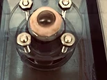 Live donor-eye perfusion rig photograph: anterior segment held in a clear acrylic chamber