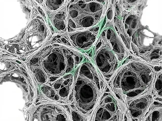 Scanning electron microscopy of the trabecular meshwork cellular lattice