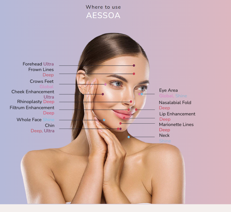 Where to use Aessoa — facial injection areas