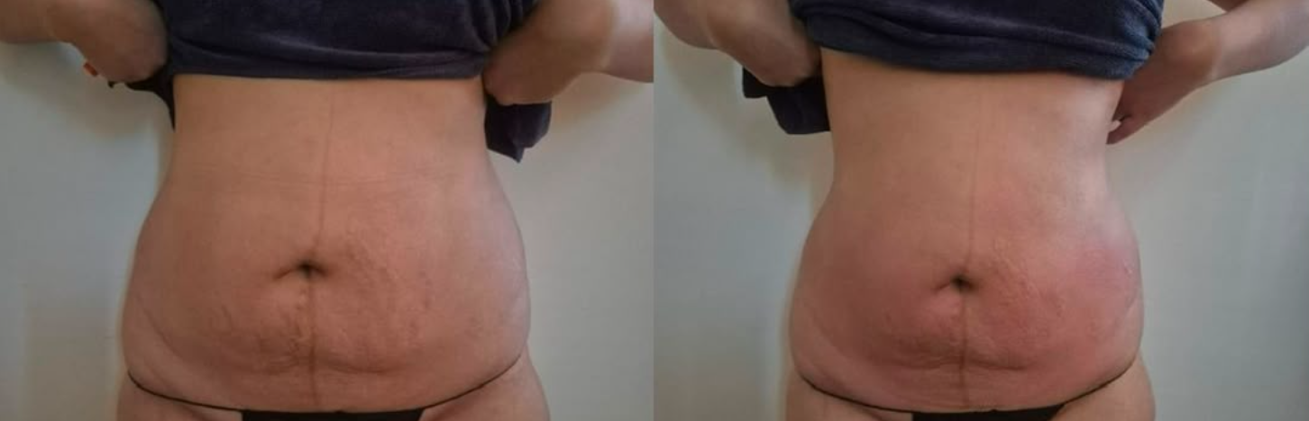 Transformation 2