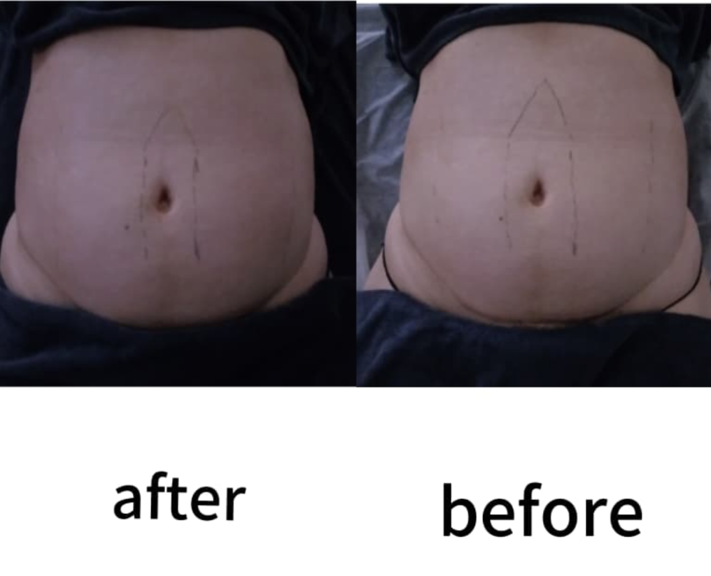 Transformation 7