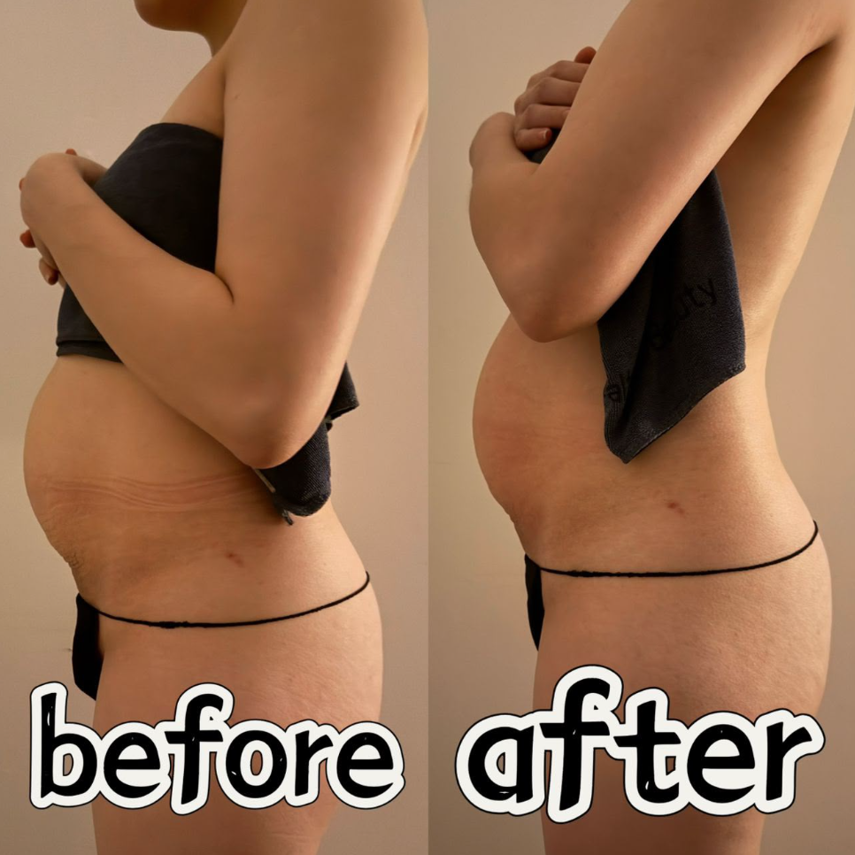 Transformation 1