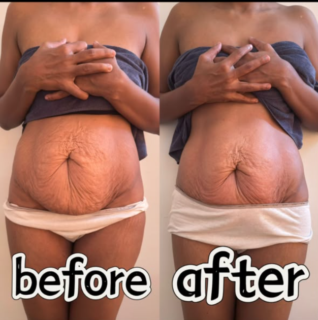 Transformation 6