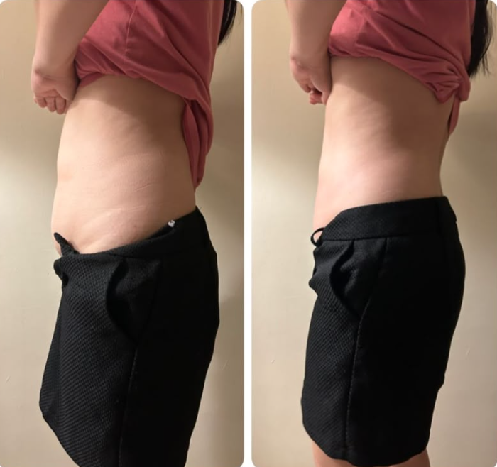 Transformation 4