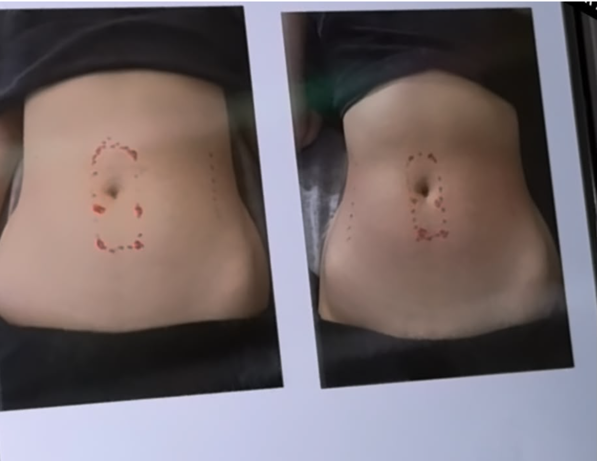 Transformation 5