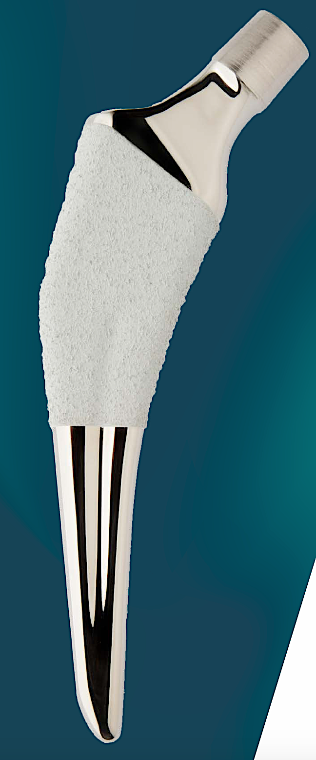Stelo femorale corto (SHORT STEM): porzione prossimale con rivestimento poroso per l'integrazione ossea e porzione distale lucida.