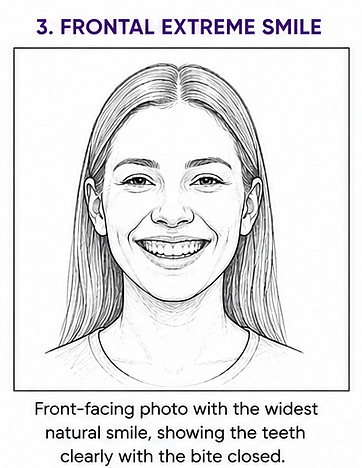 Frontal Extreme Smile