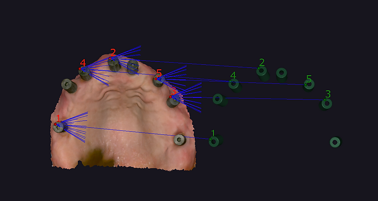 Photogrammetry file alignment showing point-to-point registration between tissue scan and photogrammetry model