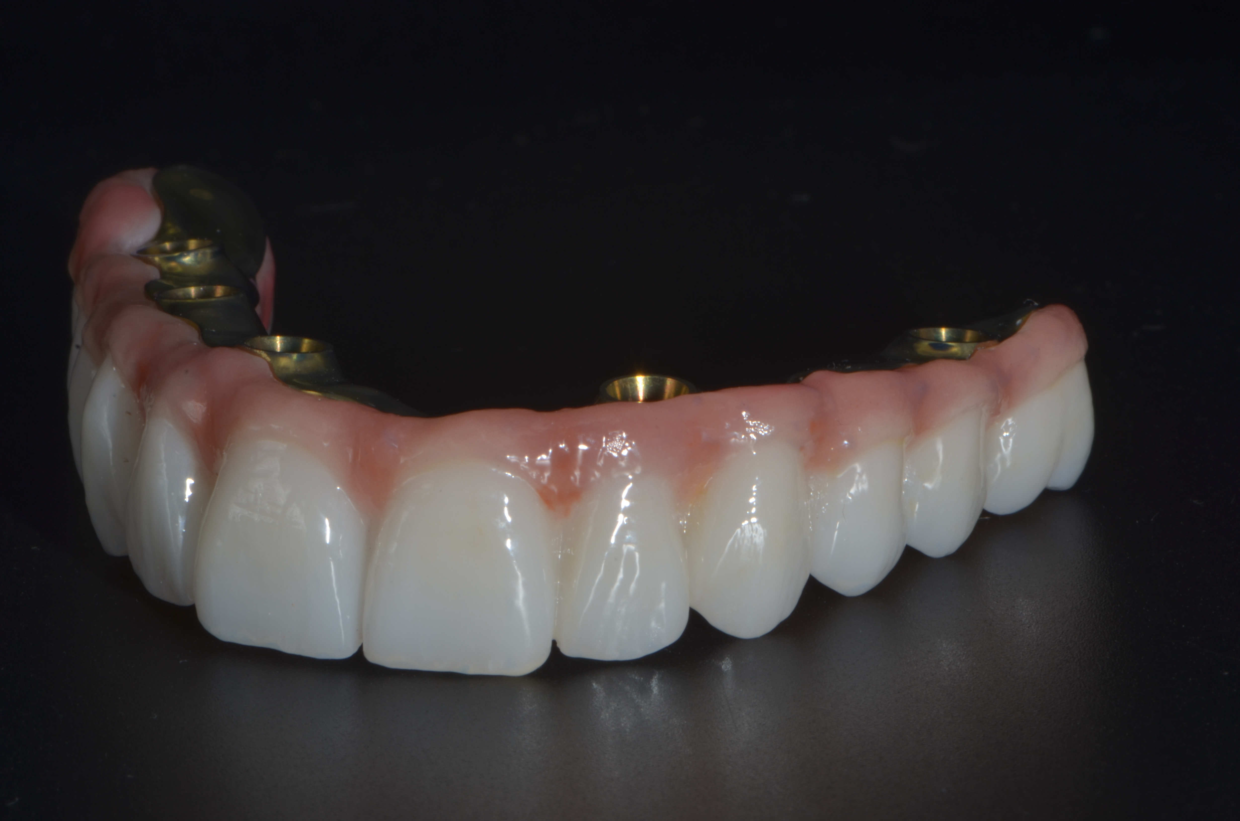 Implant Interface