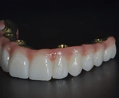 Zirconia & Titanium