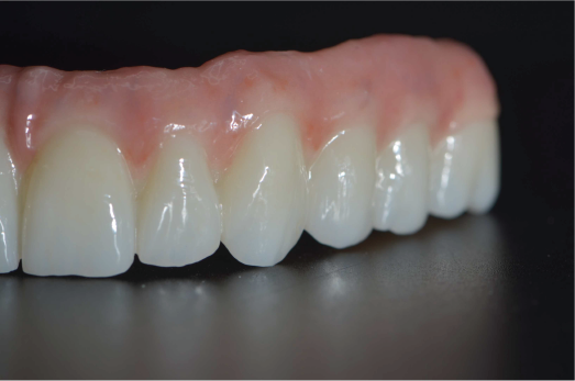 Zirconia Finish