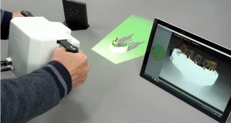 iCam4D scanner with tablet showing real-time 3D reconstruction of dental arch
