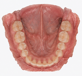 Mandibular tissue scan