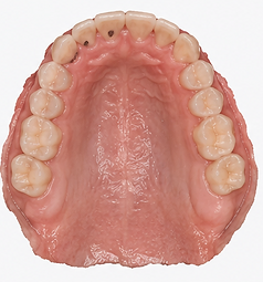 Maxillary tissue scan