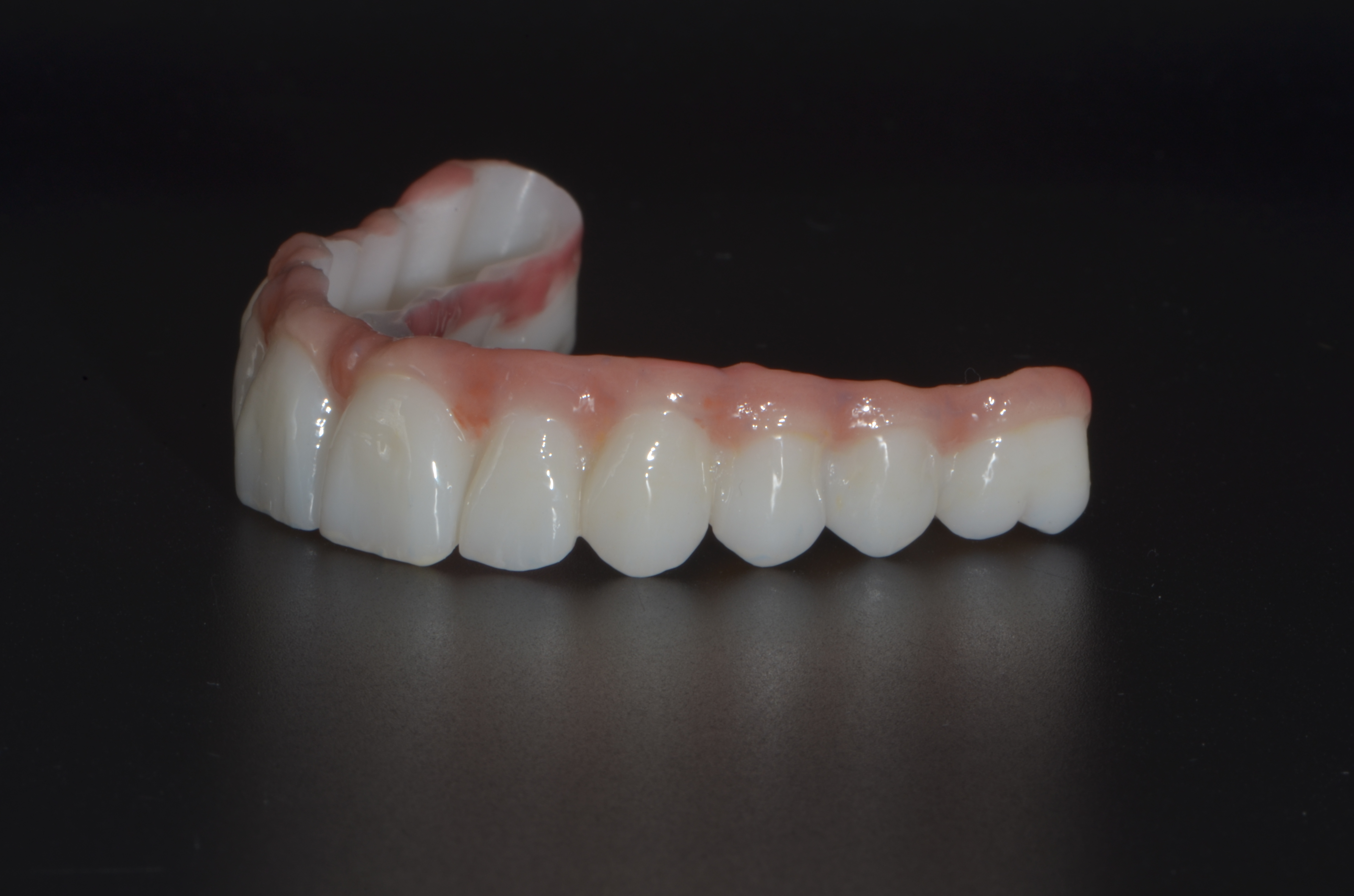 Completed Restoration