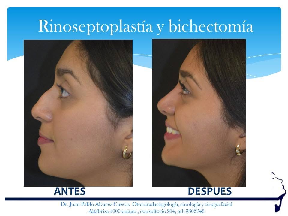 Caso Clínico Antes y Después 3